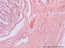 Viso microscpica de Estmago, mostrando o epitlio muscular liso e gorduras. Colorao: Hematoxilina Eosina. Aumento de 200x. <br/><br/> Palavras-chave: Histologia. Microscopia. Tecidos. Digesto. Lipdeos. Estmago. 