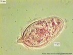 Larva que se desenvolve a partir de ovos do verme Schistosoma mansoni. Apresenta clios, com os quais, nada em busca do caramujo Biophalaria glabrata, seu hospedeiro.<br /> <br /> Palavra-chave: platelmintes, barriga d'gua, cercrias, Schistosoma, caramujo, esquistossomose.