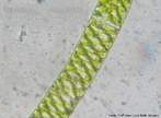 Alga filamentosa de colorao verde, encontrada em ambientes de gua doce. Apresenta parede celular composta por duas camadas: a camada externa  formada por pectina, enquanto a interna  revestida por celulose.<br/> <br/> Palavras-chave: Chlorophyta, filamentos, protista. 