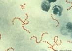 Bactrias do tipo estreptococos causam a faringite, vivem em colnias lineares ou em pares.<br /> <br /> palavra-chave: Bactrias. Estreptococos. Colnias. Linear. Par. Faringite. Biologia. Microbiologia. Cincias. 