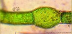 Contribuio da Professora Vera Lucia Bellin Mariano. Alga verde filamentosa simples, apresenta estrutura celular. Algumas clulas do filamento apresentam anis de crescimento (capuz).<br /> <br /> palavra-chave: Chlorophyta, Oedogoniales, protista.