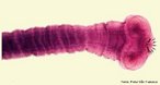 As tnias, vermes achatados pertencentes ao filo plathelmintes, apresentam o corpo dividido em esclex (cabea), colo (pescoo) e proglotes (anis). A Taenia solium apresenta, no esclex, uma coroa de ganchos denominada rostro que auxilia na fixao do verme  mucosa intestinal. <br/><br/> Palavras-chave: platelmintes, cestides, tenase, vermes, cisticercose, sunos. 